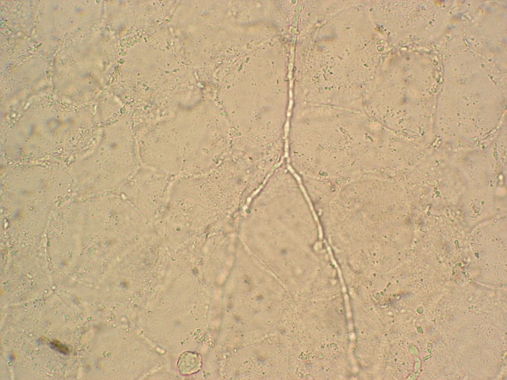 镜检下的真菌菌丝